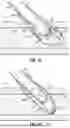 Fig. 16 - VESSEL CLOSURE DEVICES AND METHODS