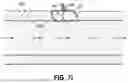 Fig. 19 - VESSEL CLOSURE DEVICES AND METHODS