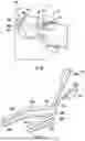 Fig. 07 - GAUZE PLACEMENT APPARATUSES AND RELATED METHODS