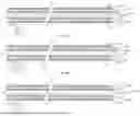 Fig. 09 - CATHETERS AND SYSTEMS FOR DIRECT INJECTION OF GAS-ENRICHED LIQUID INTO A PATIENT