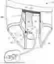 Fig. 01 - Devices, Systems, and Methods for Stabilizing Medical Tubing Protruding from a Patient