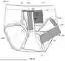 Fig. 07 - Devices, Systems, and Methods for Stabilizing Medical Tubing Protruding from a Patient