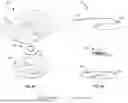Fig. 16 - Devices, Systems, and Methods for Stabilizing Medical Tubing Protruding from a Patient