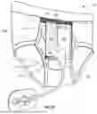 Fig. 26 - Devices, Systems, and Methods for Stabilizing Medical Tubing Protruding from a Patient