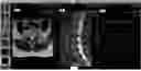 Fig. 01 - SYSTEMS, DEVICES, AND METHODS FOR GENERATING DATA SERIES TO VISUALIZE QUANTITATIVE STRUCTURE DATA REGISTERED TO IMAGING DATA
