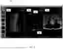Fig. 06 - SYSTEMS, DEVICES, AND METHODS FOR GENERATING DATA SERIES TO VISUALIZE QUANTITATIVE STRUCTURE DATA REGISTERED TO IMAGING DATA