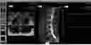 Fig. 08 - SYSTEMS, DEVICES, AND METHODS FOR GENERATING DATA SERIES TO VISUALIZE QUANTITATIVE STRUCTURE DATA REGISTERED TO IMAGING DATA