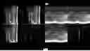 Fig. 22 - SYSTEMS, DEVICES, AND METHODS FOR GENERATING DATA SERIES TO VISUALIZE QUANTITATIVE STRUCTURE DATA REGISTERED TO IMAGING DATA