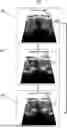 Fig. 01 - Medical Image Augmentation