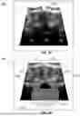 Fig. 02 - Medical Image Augmentation