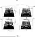 Fig. 08 - Medical Image Augmentation