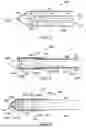 Fig. 02 - COMBINATION PROBE FOR CRYOABLATION AND THERMAL ABLATION WITH EXTERNAL HEATER