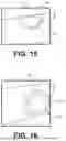 Fig. 09 - APPARATUS, SYSTEMS AND METHODS FOR A BRAZED JOINT