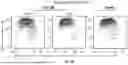 Fig. 05 - Treatment Of Multiple Sclerosis And Neuromyelitis Optica