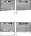 Fig. 08 - Treatment Of Multiple Sclerosis And Neuromyelitis Optica
