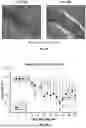 Fig. 09 - Treatment Of Multiple Sclerosis And Neuromyelitis Optica