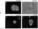 Fig. 07 - Synthetic Matrices for Cell Culture, Methods of Making and Use Thereof