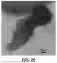 Fig. 43 - IN VITRO GENERATION OF ORGANIZED 3D CELL STRUCTURES INCLUDING HEAD-TRUNK EMBRYO-LIKE STRUCTURES, USING EPIGENETIC REMODELING FACTORS-MICROFLUIDIC PLATFORM SUITABLE FOR THEIR GENERATION