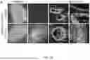 Fig. 04 - STRUCTURALLY COMPLETE ORGANOIDS
