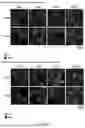 Fig. 136 - TYPE I-B CRISPR-ASSOCIATED TRANSPOSASE SYSTEMS