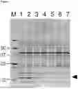 Fig. 02 - BACILLUS LICHENIFORMIS HOST CELL FOR PRODUCTION OF A COMPOUND OF INTEREST WITH INCREASED PURITY