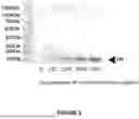 Fig. 04 - TRANSCRIPTION FACTOR BINDING SITE ANALYSIS OF NUCLEOSOME DEPLETED CIRCULATING CELL FREE CHROMATIN FRAGMENTS