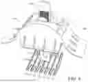 Fig. 05 - LIPPAGE CONTROL SYSTEM WITH STRETCHABLE STRAP PORTION