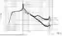 Fig. 04 - MEASUREMENT SYSTEM FOR MEASURING A FLOW PARAMETER OF A FLUID MEASUREMENT SUBSTANCE FLOWING IN A PIPELINE