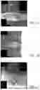 Fig. 02 - MR SPECTROSCOPY SYSTEM AND METHOD