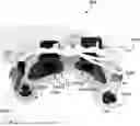 Fig. 01 - METHODS, SYSTEMS, AND DEVICES FOR DETERMINING A STATUS OF BRAIN AND/OR NERVE FUNCTIONS OF A PATIENT