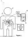 Fig. 02 - METHOD AND SYSTEM FOR VALIDATING OPTIMAL BODY SENSOR PLACEMENT