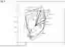 Fig. 02 - METHOD FOR PROVIDING TRIGGER INFORMATION IN MEDICAL RADIOLOGY