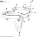 Fig. 02 - SYSTEMS AND METHODS FOR KNEE ARTHROPLASTY