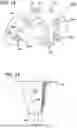 Fig. 09 - SYSTEMS AND METHODS FOR KNEE ARTHROPLASTY