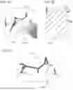 Fig. 35 - SYSTEMS AND METHODS FOR KNEE ARTHROPLASTY