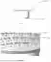 Fig. 37 - SYSTEMS AND METHODS FOR KNEE ARTHROPLASTY