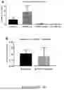 Fig. 04 - COMPOSITIONS AND METHODS TO SUPPRESS TUMOR GROWTH IN BONE, PREVENT CACHECTIC MUSCLE LOSS, AND PRESERVE SKELETAL INTEGRITY