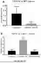 Fig. 06 - COMPOSITIONS AND METHODS TO SUPPRESS TUMOR GROWTH IN BONE, PREVENT CACHECTIC MUSCLE LOSS, AND PRESERVE SKELETAL INTEGRITY