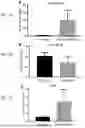 Fig. 08 - COMPOSITIONS AND METHODS TO SUPPRESS TUMOR GROWTH IN BONE, PREVENT CACHECTIC MUSCLE LOSS, AND PRESERVE SKELETAL INTEGRITY