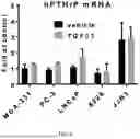 Fig. 09 - COMPOSITIONS AND METHODS TO SUPPRESS TUMOR GROWTH IN BONE, PREVENT CACHECTIC MUSCLE LOSS, AND PRESERVE SKELETAL INTEGRITY