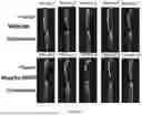 Fig. 16 - COMPOSITIONS AND METHODS TO SUPPRESS TUMOR GROWTH IN BONE, PREVENT CACHECTIC MUSCLE LOSS, AND PRESERVE SKELETAL INTEGRITY