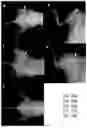 Fig. 20 - COMPOSITIONS AND METHODS TO SUPPRESS TUMOR GROWTH IN BONE, PREVENT CACHECTIC MUSCLE LOSS, AND PRESERVE SKELETAL INTEGRITY