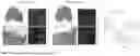 Fig. 32 - METHODS FOR PROMOTING TISSUE REGENERATION