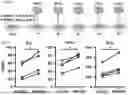 Fig. 09 - COMPOSITIONS AND METHODS COMPRISING CAR T CELLS COMPRISING PRDM1 AND/OR NR4A3 KNOCKOUT