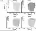 Fig. 37 - COMPOSITIONS AND METHODS COMPRISING CAR T CELLS COMPRISING PRDM1 AND/OR NR4A3 KNOCKOUT