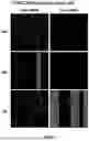 Fig. 04 - Therapeutic Compounds for Inhibiting and Reducing the Expression of Cell Surface Proteins