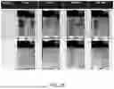 Fig. 22 - MINERAL-COATED SUBSTRATES FOR STABILIZATION OF RNA-BASED THERAPEUTIC COMPOSITIONS