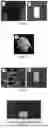 Fig. 02 - LARGE APERTURE-BASED TISSUE ENGINEERING SCAFFOLD AND USE THEREOF