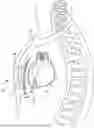 Fig. 01 - SUPRAVENTRICULAR TACHYARRHYTHMIA DISCRIMINATION