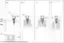 Fig. 01 - METHOD FOR PROCESSING A BIOLOGICAL SAMPLE WITH MAGNETIC PARTICLES